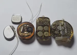 Arne Larsson, 1915-2001 known as the world's first person to receive an artificial cardiac pacemaker. The pacemaker was implanted by heart surgeon Ake Senning in 1958