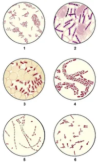 Bacteria smears of germs for microbiological diagnosis