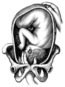 Birth, historical illustration from: Anna Fischer Dueckelmann