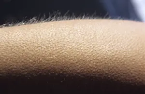 Close-up shot, goosebumps