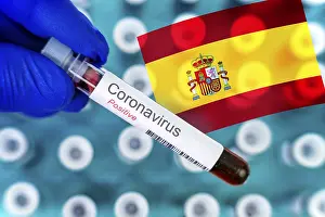 Digital Composing, Laboratory physician holds a blood test tube with positive test result