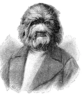 Dog-Faced Man, Fedor Adrianovich Jeftichew