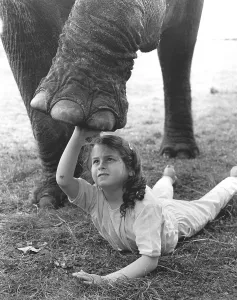 Girl with elephant leg, England, Great Britain