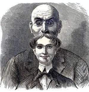 Hair growth in youth and old age