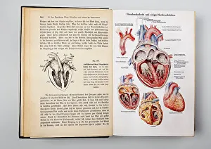 Heart diseases, illustrations from the book Dr