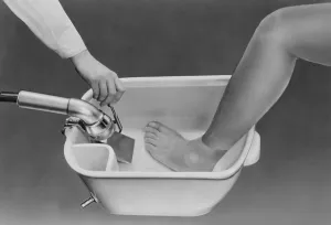 Historic photograph, ultrasonic device
