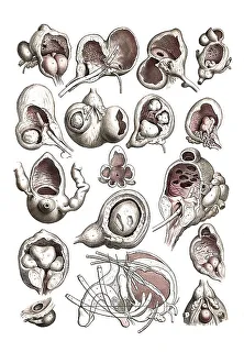Human anatomy, medicine, operations on a man's bladder from various positions