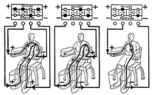 An illustration of a patient being treated with a four cell Schnee Bath