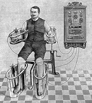 An illustration of a patient being treated with a four cell Schnee Bath