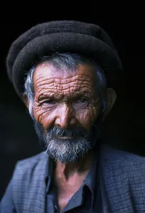 Man suffering from cretinism, mental and physical disability