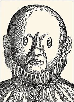 Mask to cure strabismus, Georg Bartisch