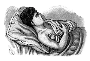 Measuring body temperature, historical illustration