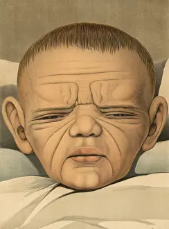 Medical illustration, clinical picture