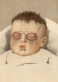 Medical illustration, clinical picture