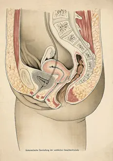 Medical illustration, clinical picture