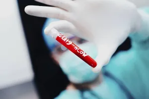 Medical professional showing a test tube labeled 2019-nCoV in gloved hand