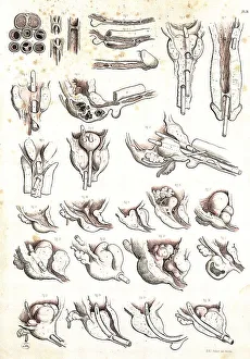 Medicine, Anatomy, Operation on a male urethral obstruction