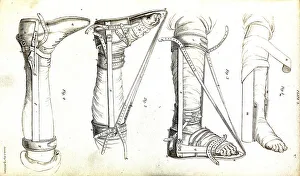Medicine, Anatomy, Surgery, Apparatus for the correction of clubfoot after surgery