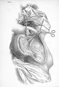 Medicine, anatomy, surgery, breast cancer