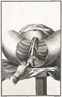 Medicine, Anatomy, Surgery, Examination of the Perineum
