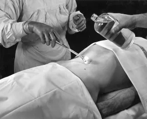 Medicine, health, operation on the stomach