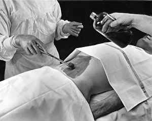Medicine, health, operation on the stomach