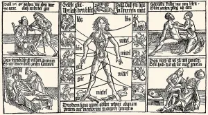 Medicine treatment, bloodletting procedure