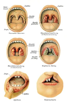 Mouth and throat diseases, health counselor