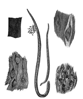 Muscle trichinae, woodcut from 1864