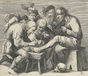 Operation on the foot for teaching purposes by a doctor in the Middle Ages many students are present