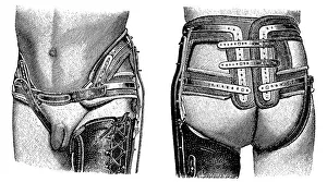 Pelvic girdle, brace, state of the art of therapeutic techniques