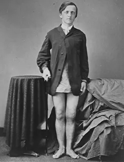 War-wounded Private G. W. Warrington